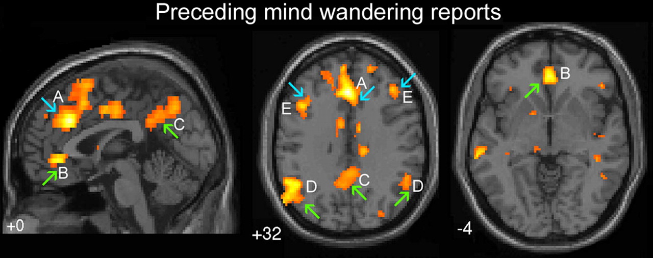 Зелёными стрелками показаны области мозга, ответственные за «автоматическое поведение».