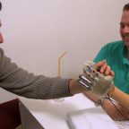 Бионический протез замещает чувство осязания утраченной руки