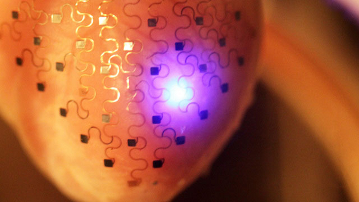 3D-имплантат ранней диагностики сердечных заболеваний