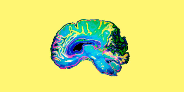 Раскрашенный МРТ-снимок мозга /// Wired