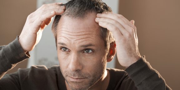5 причин выпадения волос, о которых вы могли не задумываться