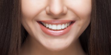 Отбеливание зубов в домашних условиях: 11 простых способов