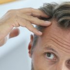 Как предотвратить выпадение волос: 4 способа, проверенных медициной