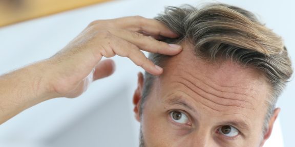 Как предотвратить выпадение волос: 4 способа, проверенных медициной