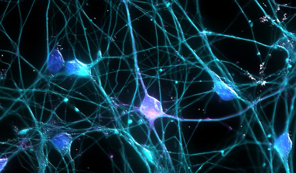 Новые клетки мозга. Клетки мозга. Клетки мозга под микроскопом. Нейронные связи. Нейроны мозга.