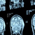 Как технологии помогут поддерживать здоровье мозга в цифровую эпоху