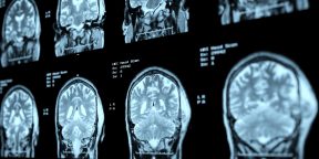 Как технологии помогут поддерживать здоровье мозга в цифровую эпоху