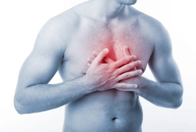 мифы о здоровье: сердечный приступ