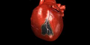 8 признаков инфаркта миокарда, при которых нужно звонить в скорую