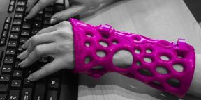 ActivArmor — альтернатива медицинскому гипсу, напечатанная на 3D-принтере