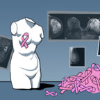 Как распознать рак груди и что делать дальше