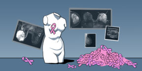 Как распознать рак груди и что делать дальше