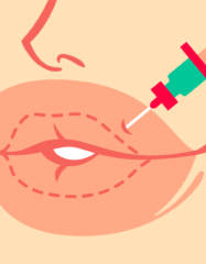 12 фактов, которые надо знать об увеличении губ