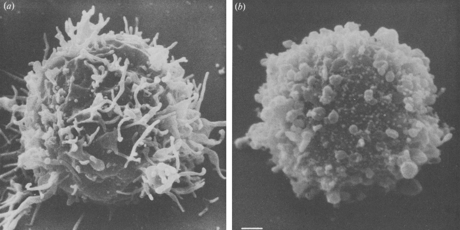 Вич 40. Вирус иммунодефицита под микроскопом. ВИЧ электронная микроскопия. Вирус СПИДА под микроскопом. Вирус ВИЧ пол миркоскоп.