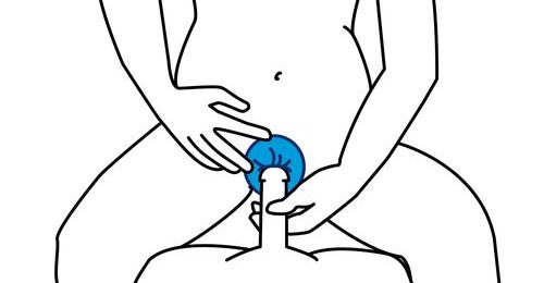 Как работают женские презервативы | Купрум