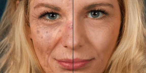 Это приложение покажет, что станет с вашей кожей, если не защищать её от солнца