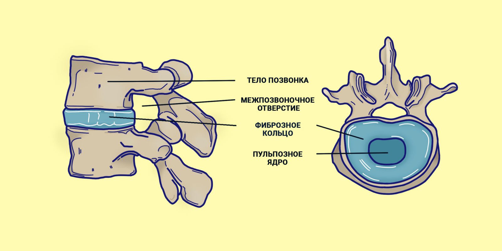 Схема строения межпозвонкового диска