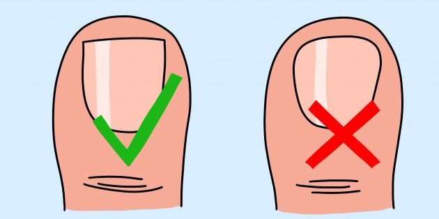 К чему приводит неправильная стрижка ногтей и как избежать проблем со здоровьем - Лайфхакер