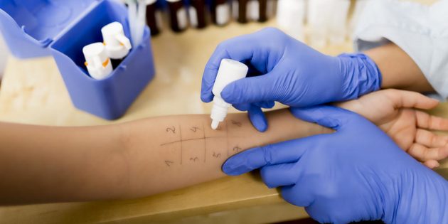 Как проводят анализ крови на аллергены thumbnail