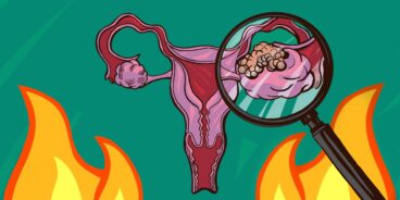 Почему болит яичник и что с этим делать? — симптомы, диагностика, лечение в НКЦ№2 (ЦКБ РАН)