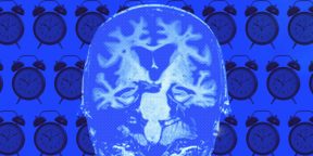 Недостаток сна может привести к болезни Альцгеймера: новые сведения от учёных