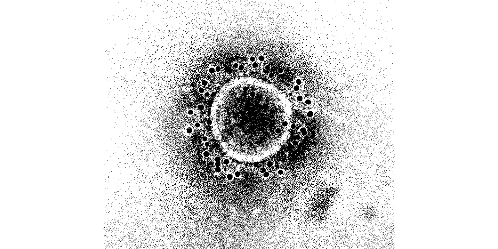 Отсутствие иммунитета к вирусу