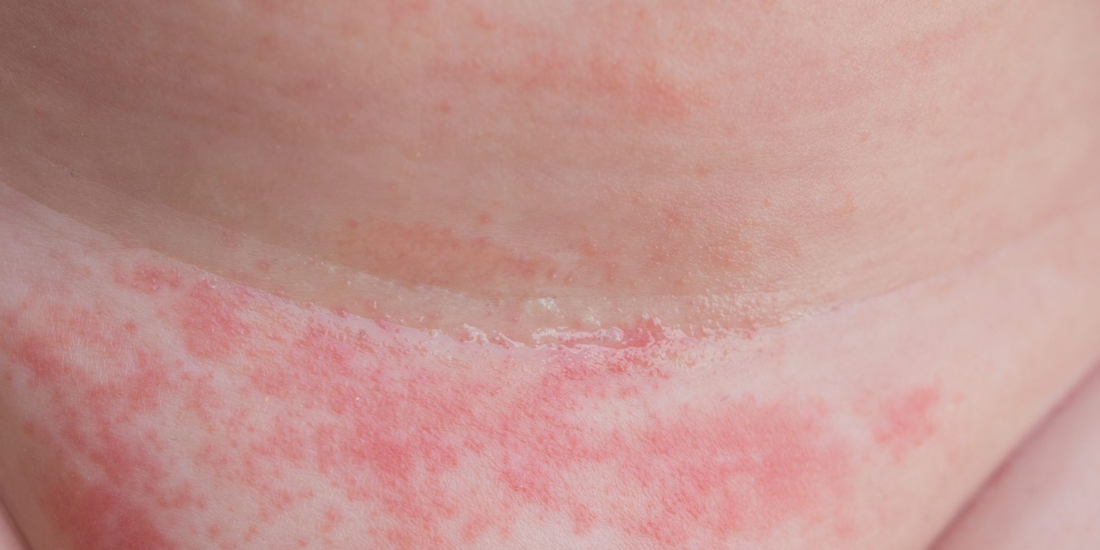 Какие факторы могут вызывать заболевание кожи?