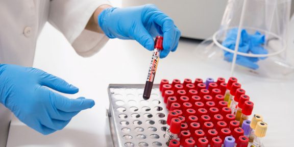 Как расшифровать биохимический анализ крови: норма показателей
