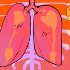 Что такое фиброз лёгких и чем он опасен