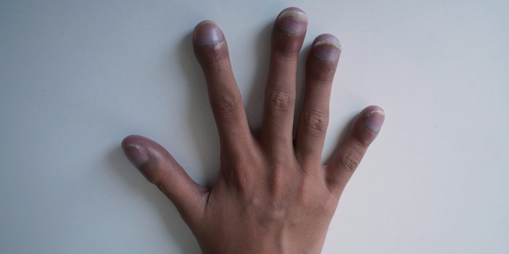 Боль и онемение пальцев руки могут свидетельствовать о серьезных заболеваниях