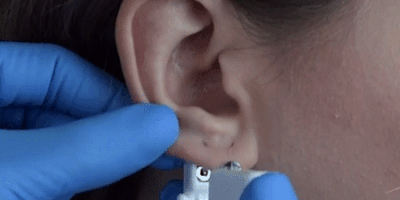 Как проколоть ухо с помощью набора для пирсинга: поместите мочку в картридж так, чтобы игла была направлена в намеченную точку