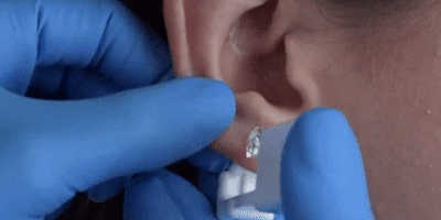 Как проколоть ухо с помощью набора для пирсинга: резко сожмите дырокол с двух сторон, а затем осторожно удалите его