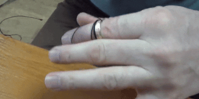 Как снять кольцо с опухшего пальца с помощью нитки: снимите кольцо