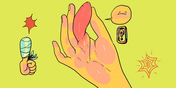 Почему опухают пальцы и что с этим делать