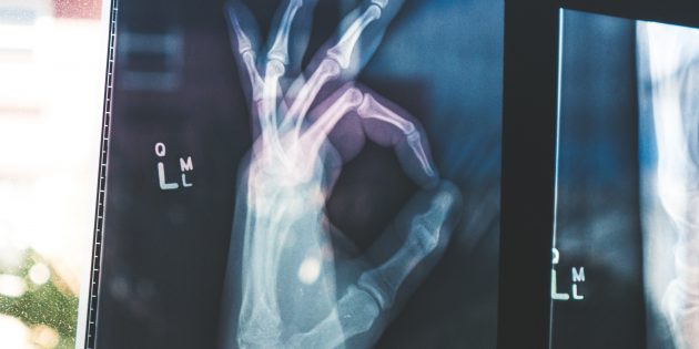 Миф 10 о воздействии радиации: рентген и флюорография опасны
