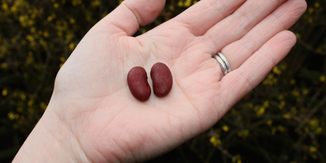 искусственные почки