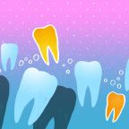 12 часто возникающих вопросов об имплантации зубов