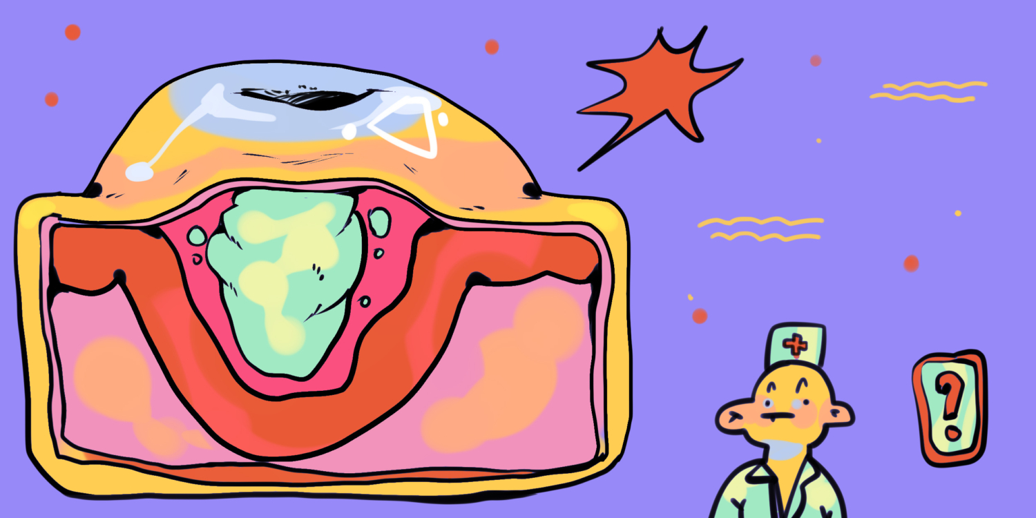 Контагиозный моллюск: фото, симптомы, лечение — Лайфхакер