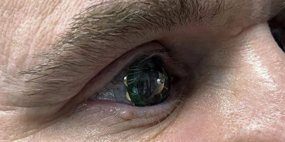 Линзы дополненной реальности Mojo Lens прошли успешное тестирование: их надел основатель компании