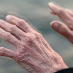 Исследование: COVID-19 увеличивает риск развития болезней Альцгеймера и Паркинсона