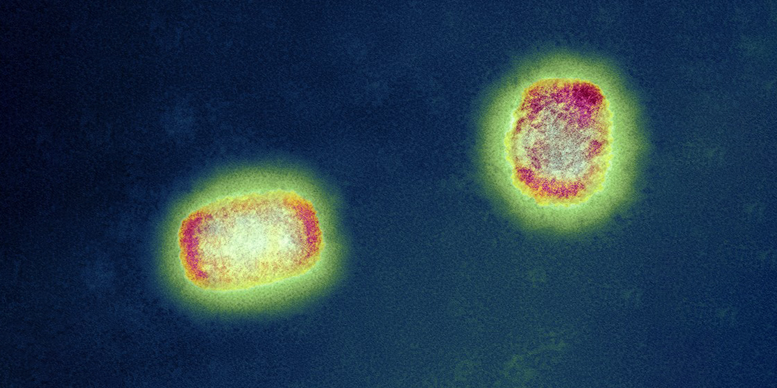 обезьянья оспа