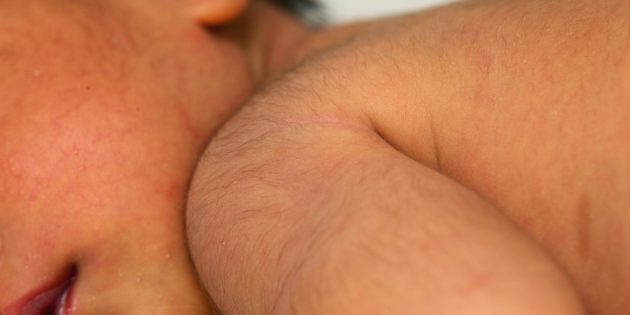 Странности новорождённых: волосатая спина