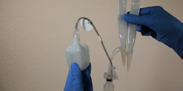 Чем заменить виагру: Надувной имплант с насосом и резервуаром с водой