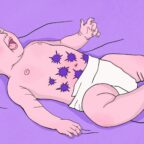 Что делать, если у новорождённого колики или фиолетовый плач