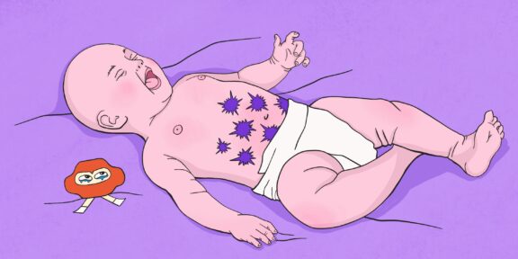 Что делать, если у новорождённого колики или фиолетовый плач
