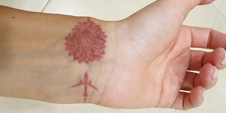 Если сделать татуировку на худые руки, а потом накачаться, что будет с татуировкой?
