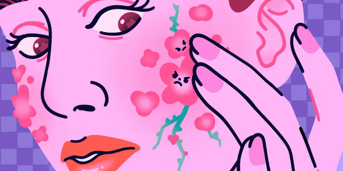 6 вредных советов для кожи с&nbsp;акне