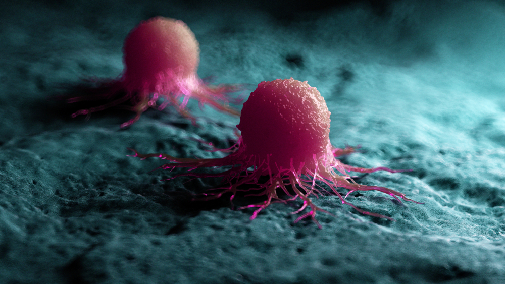 3D-визуализация раковой клетки