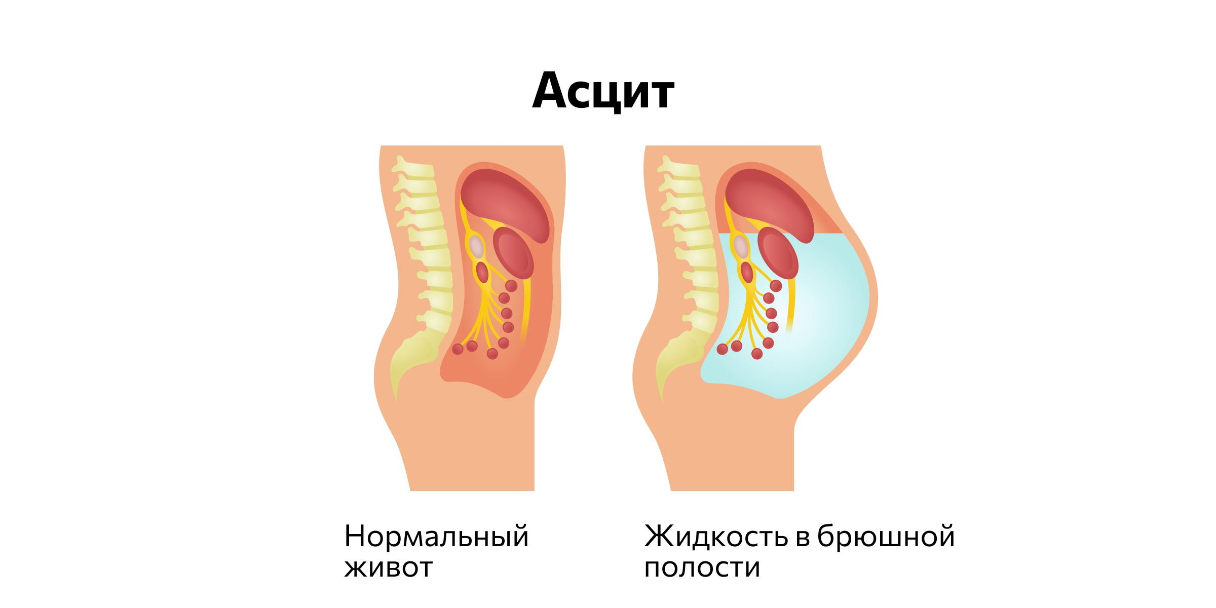 Форма живота при асците