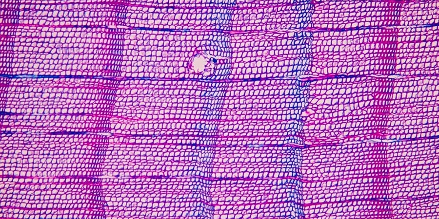 Учёные из Кембриджа рассказали, как в Европу пришла самая смертоносная чума — из-за вулканов